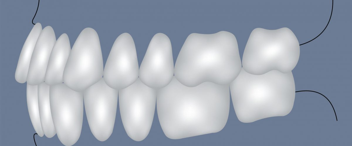 occlusion side view - bite, closure of teeth - incisor, canine, premolar, molar upper and lower jaw. Vector illustration for print or design of the dental clinic